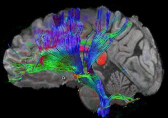 Нейроны и нейросети. Обзор основных структур головного и спинного мозга.